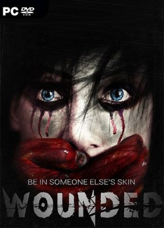 WOUNDED (2019) PC | Лицензия